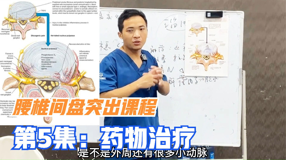 药物治疗是腰椎间盘突出常见西医方法，7分钟，详解其功效和原理